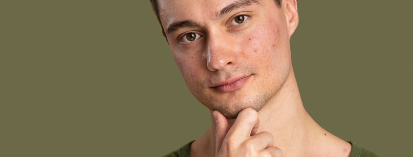Od tínedžera po dospelého: Keď akné neodchádza